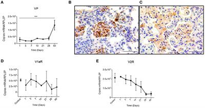 Involvement of Vasopressin in the Pathogenesis of Pulmonary Tuberculosis: A New Therapeutic Target?